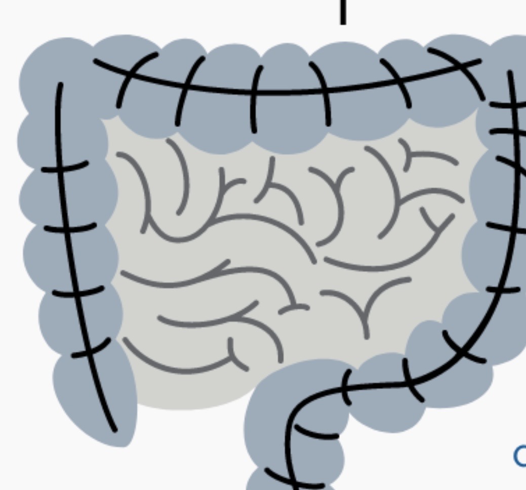 IBS